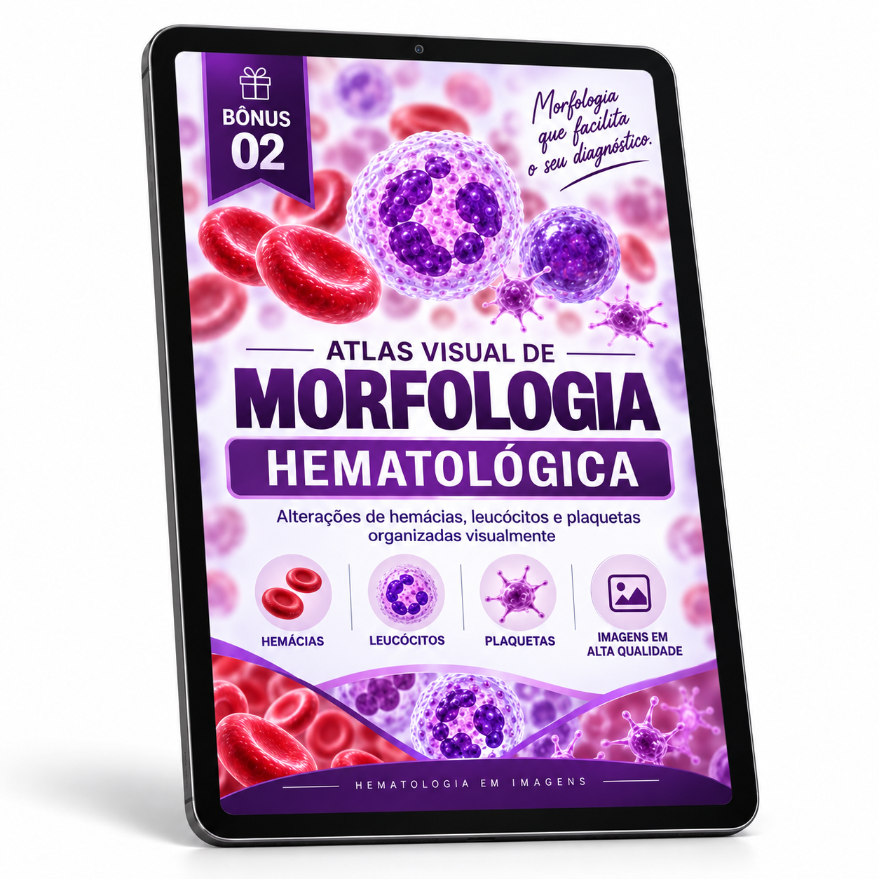 Bônus 2 — Atlas Visual de Morfologia Hematológica